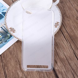 Funda para Xiaomi Redmi 5A...